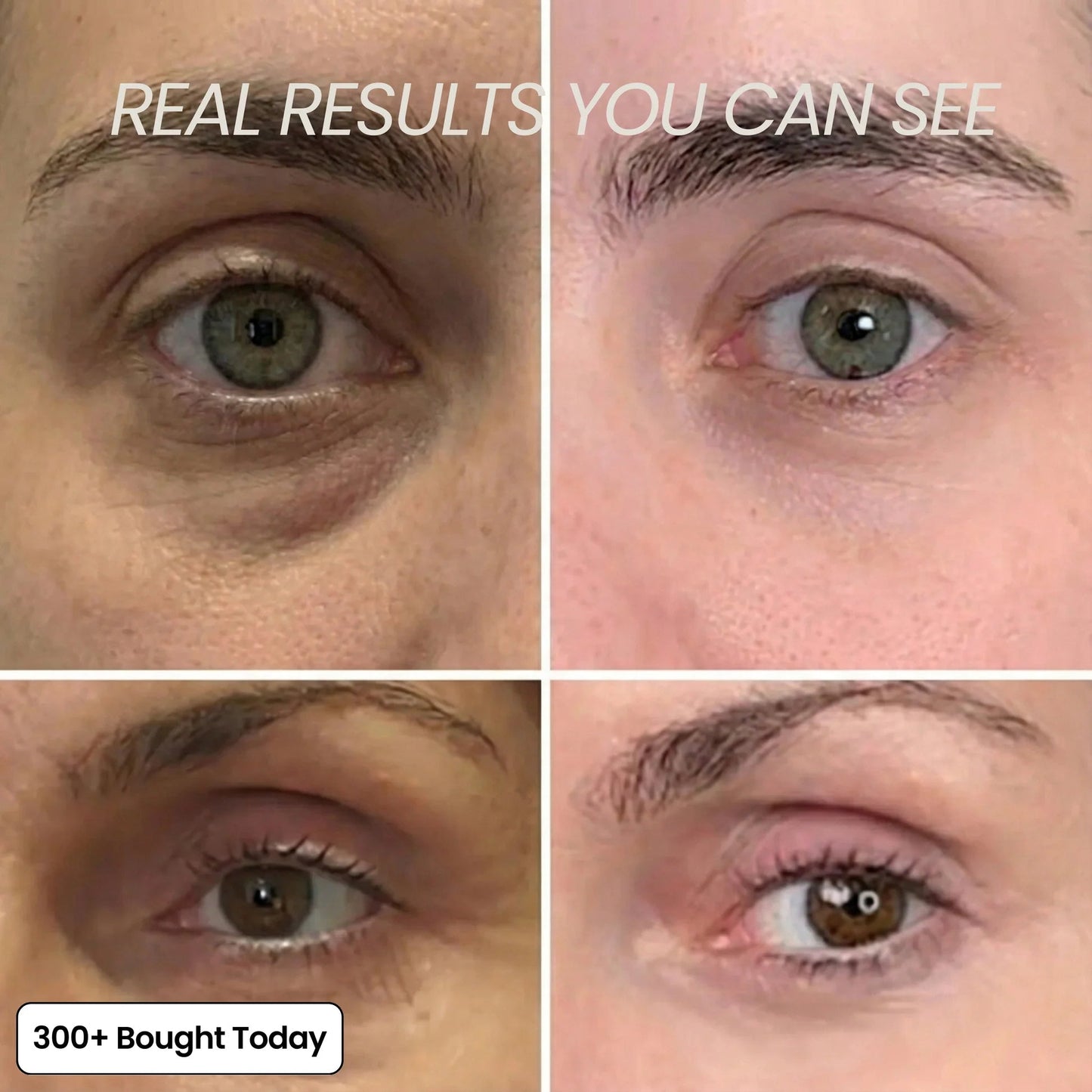 🔥 Limited-Time 60% OFF: Smooth Wrinkles & Restore a Plumper, Youthful Glow
