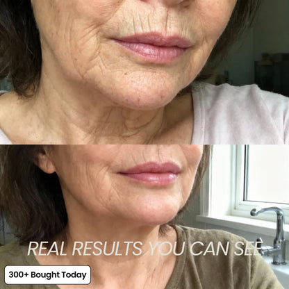 🔥 Limited-Time 60% OFF: Smooth Wrinkles & Restore a Plumper, Youthful Glow