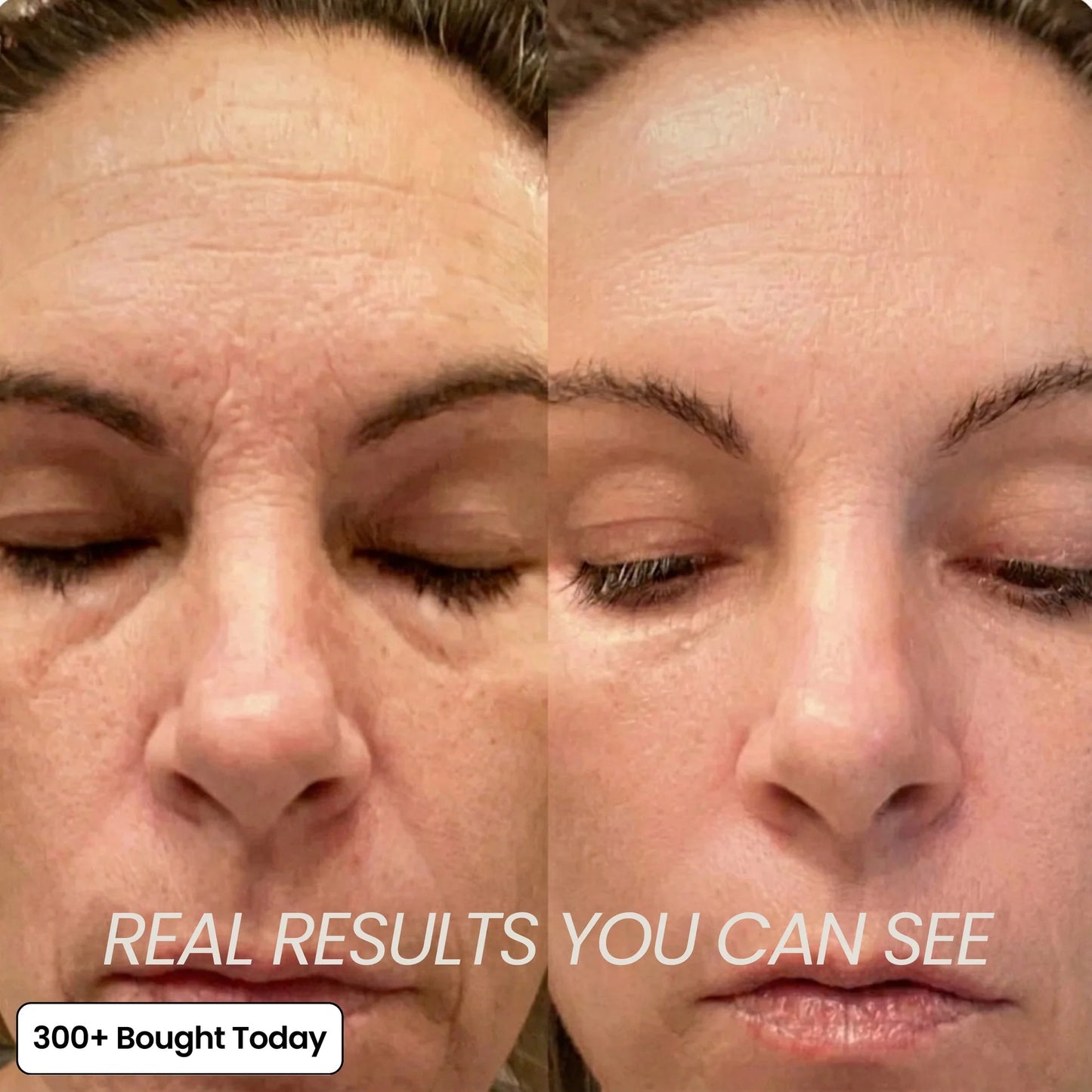 🔥 Limited-Time 60% OFF: Smooth Wrinkles & Restore a Plumper, Youthful Glow