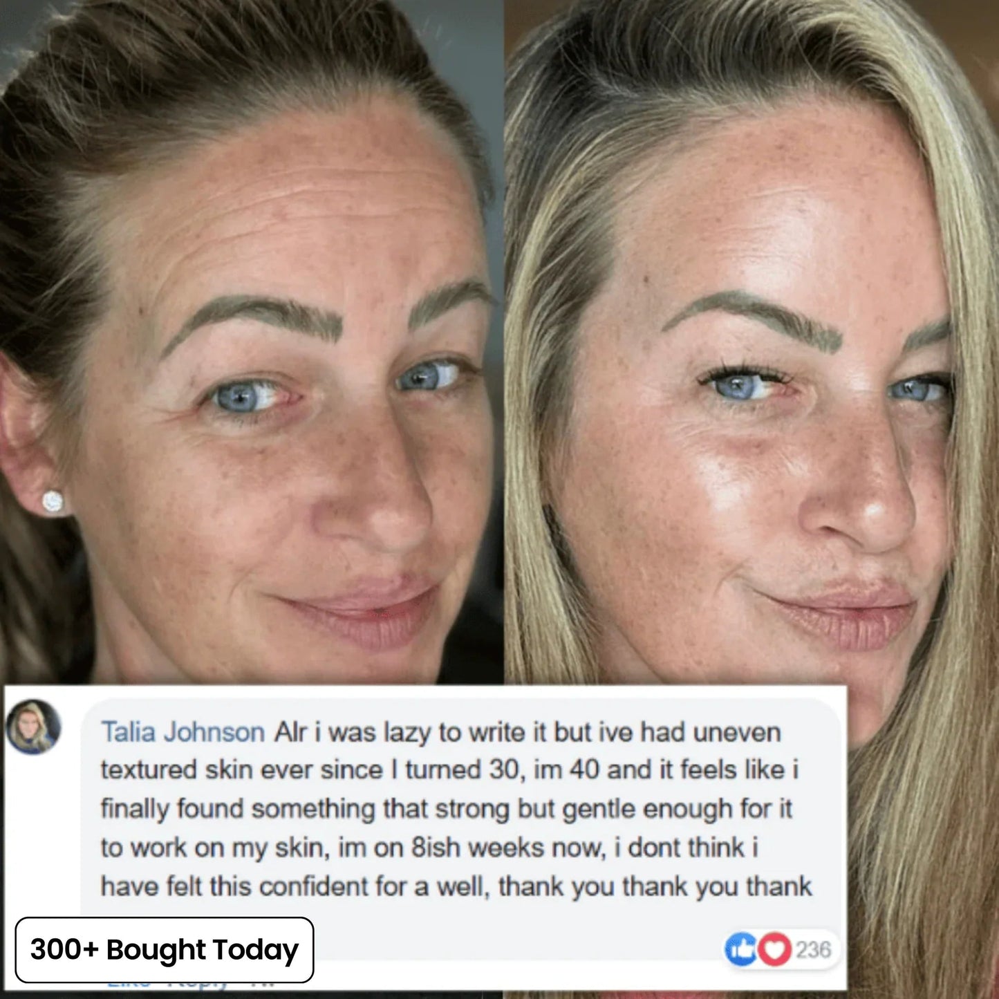 🔥 Limited-Time 60% OFF: Smooth Wrinkles & Restore a Plumper, Youthful Glow
