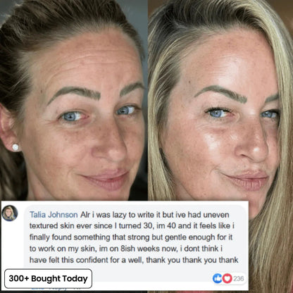 🔥 Limited-Time 60% OFF: Smooth Wrinkles & Restore a Plumper, Youthful Glow