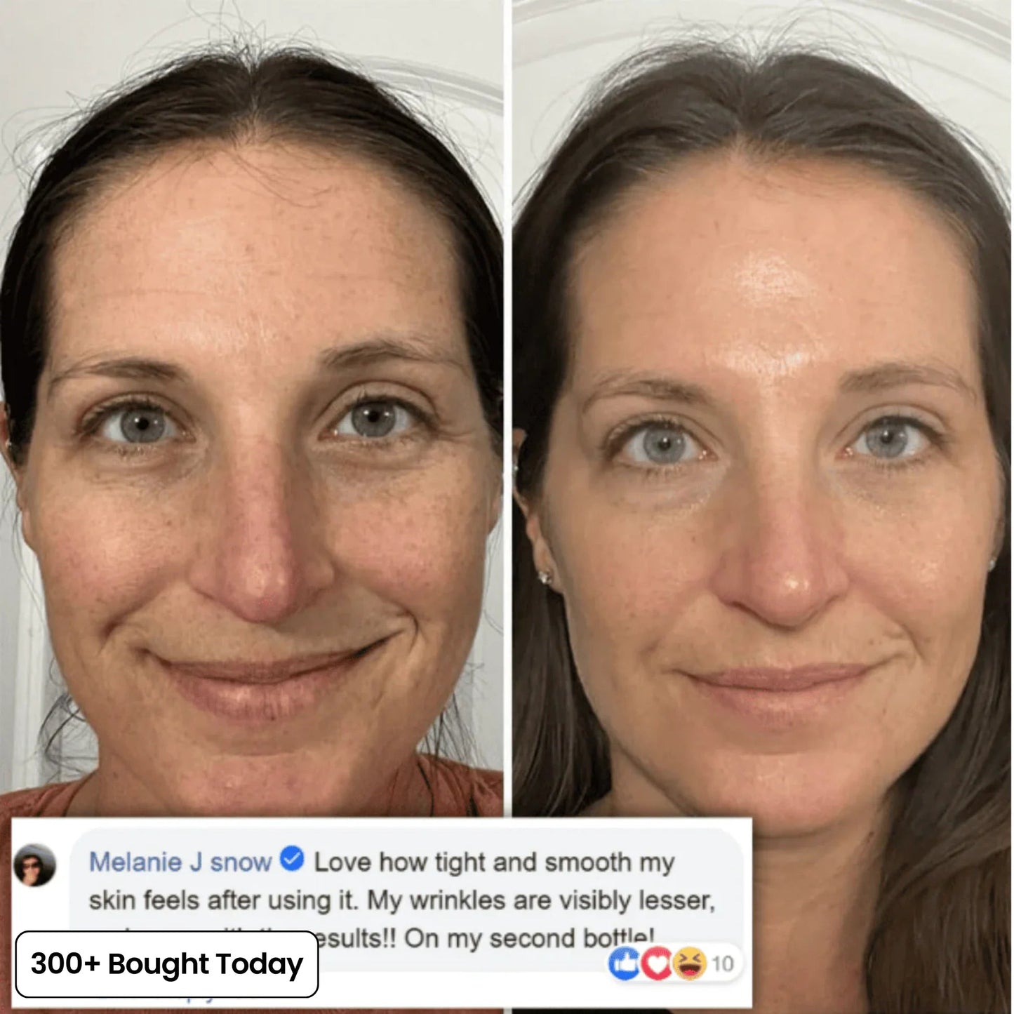 🔥 Limited-Time 60% OFF: Smooth Wrinkles & Restore a Plumper, Youthful Glow